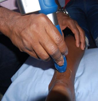 Effective Physiotherapy Management of Foot Pain: How We Can Help You Walk Pain-Free