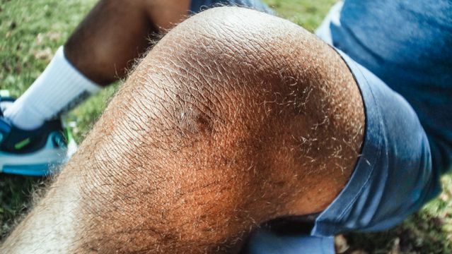 Why Does My Knee Swell? Causes, Warning Signs and Treatment